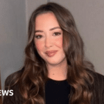 حالة كأحدغ البارجة تعانيها امرأة في قائمة الانتظار لدى طبيبة النساء