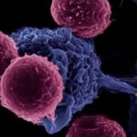 أمراض المناعة الذاتية: التشخيص، الأعراض وسبل التعايش السليم.