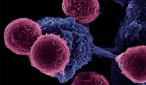 أمراض المناعة الذاتية: التشخيص، الأعراض وسبل التعايش السليم.