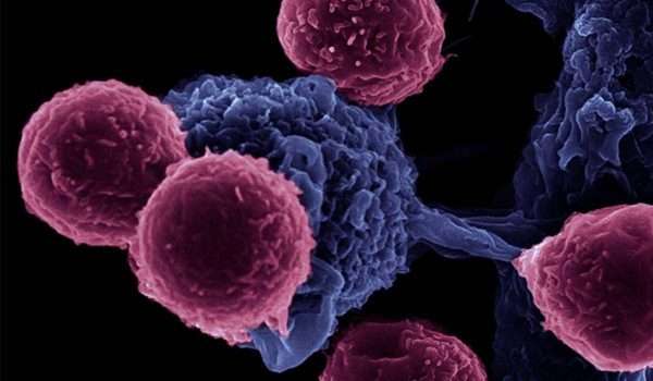 أمراض المناعة الذاتية: التشخيص، الأعراض وسبل التعايش السليم.