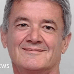 تكلفة جراحة الشبكة للجراح تصل إلى 20 مليون جنيه sterling كتعويض