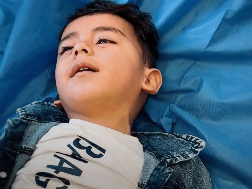 عملية جراحية معقدة تنقذ طفل في غزة من إعاقة دائمة رغم انهيار الصحة.