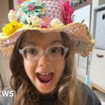 فتاة تبلغ 6 أعوام تستعيد البصر بعد إجراء علاج وراثي.